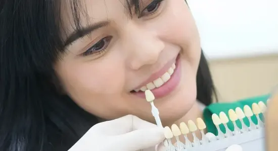 Dental Veneers Near Me