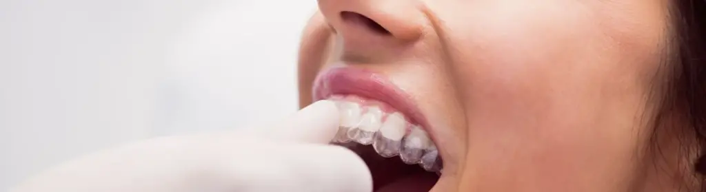 dental night guard