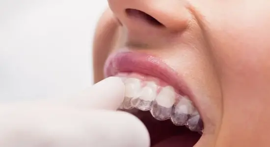 dental night guard