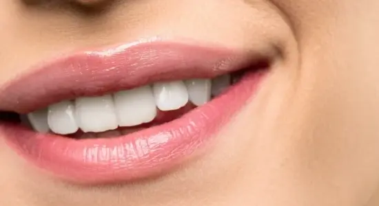 Gingivitis Treatment
