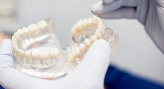 Bridge Dental