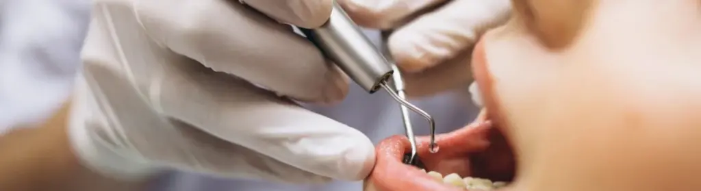 Root Canal