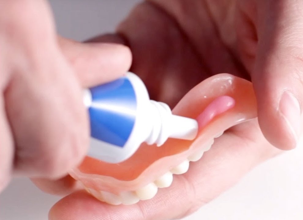 glue a tooth