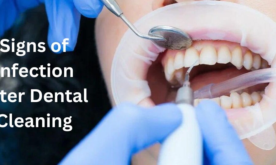 signs-of-infection-after-dental-cleaning