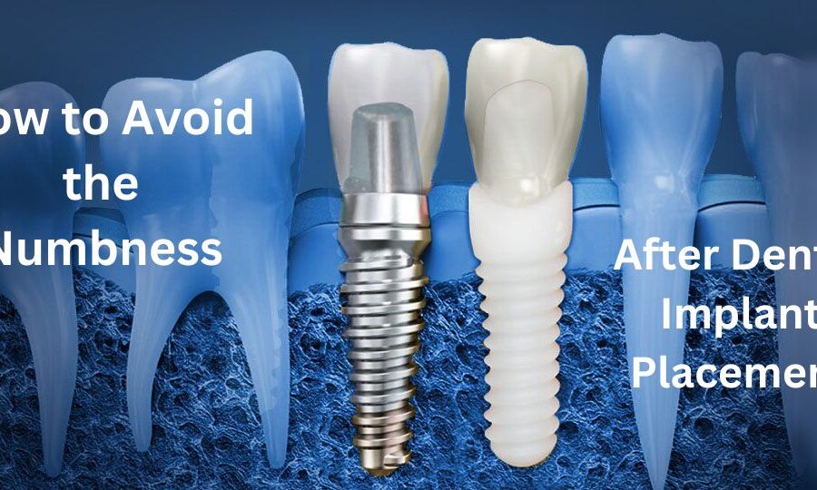 Avoid-numbness-after-dental-implants
