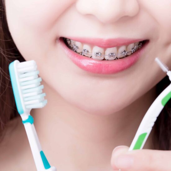How to Brush Your Teeth with Braces