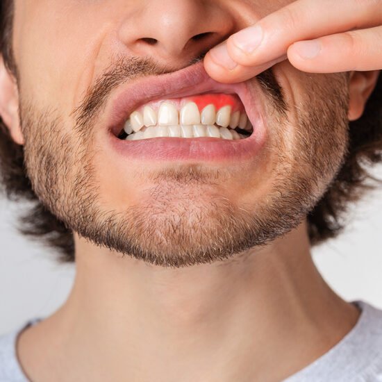 How to Know if You're Suffering from Gum Disease
