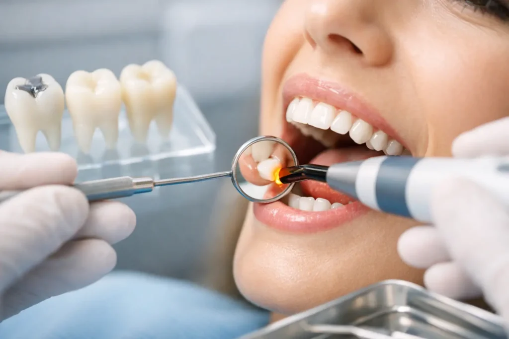 Tooth Colored Filling Benefits Worth Knowing